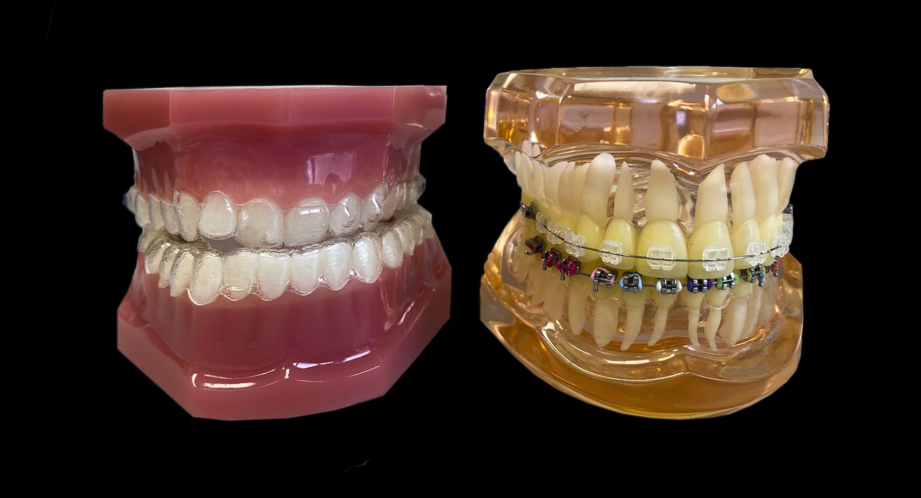 Ortodoncja w XXI wieku – nowoczesne rozwiązania dla zdrowego uśmiechu