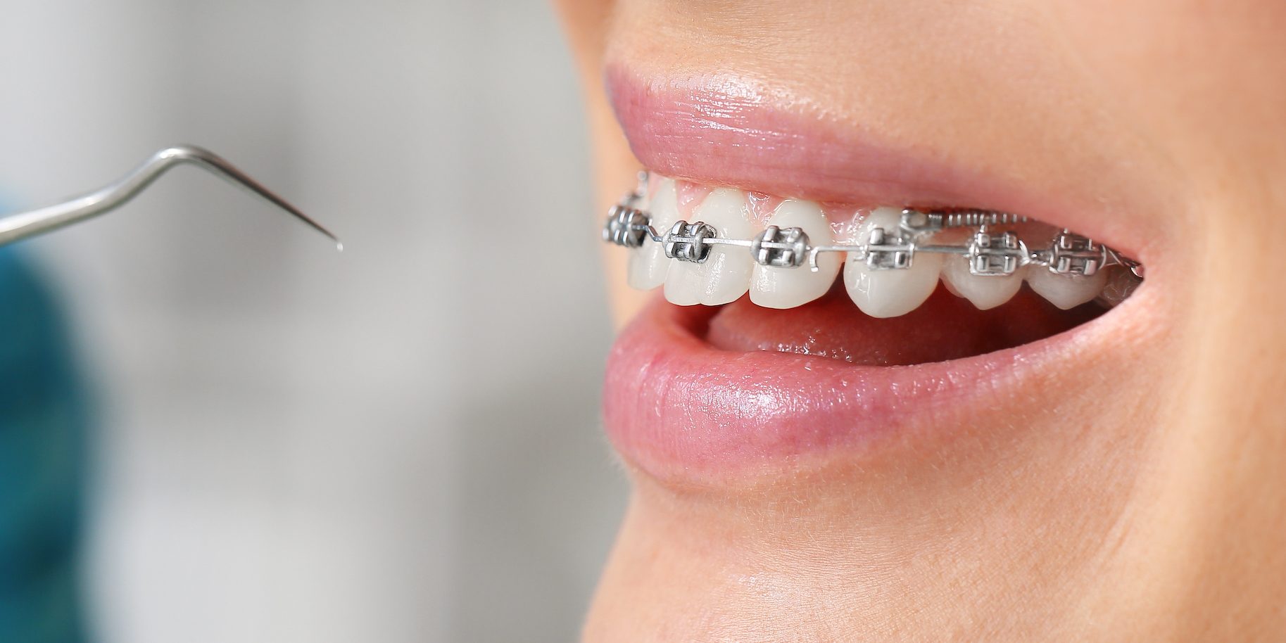 Kiedy warto skonsultować się z ortodontą?